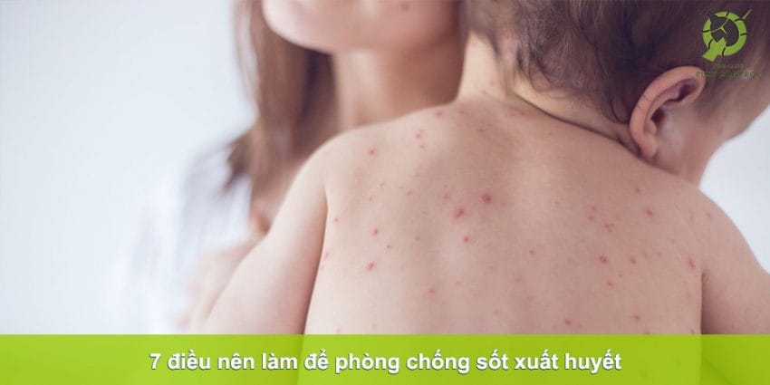 sốt xuất huyết