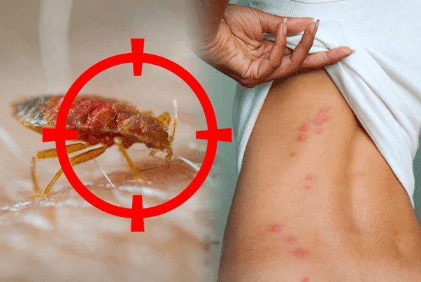 Diệt Rệp Giường 