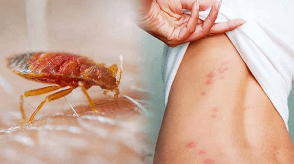Cách Diệt Rệp Tại Nhà