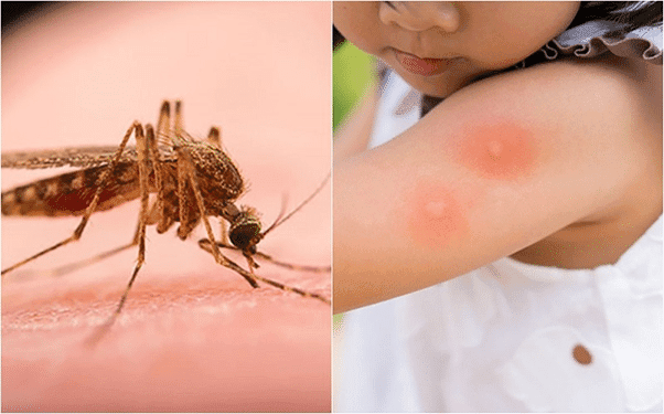 Nên Chọn Công Ty Diệt Côn Trùng Nào Uy Tín