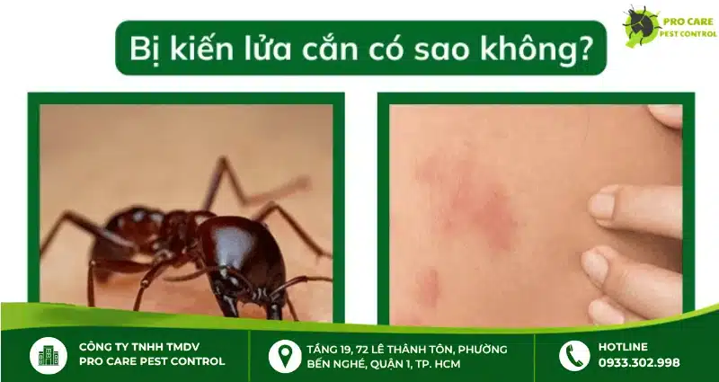 Tác hại của việc bị kiến lửa cắn